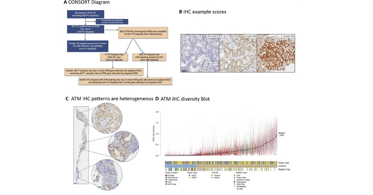 Parp inhibitor prostate cancer