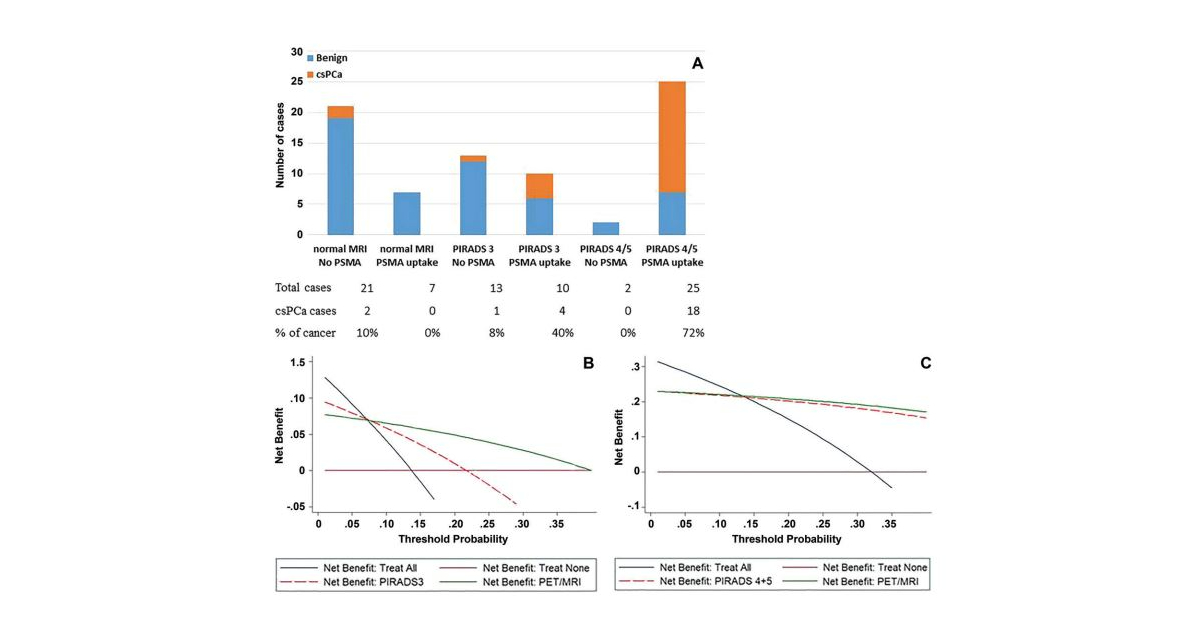 Diagnostic Performance Of 68 Ga Prostate-specific Membrane Antigen PET ...